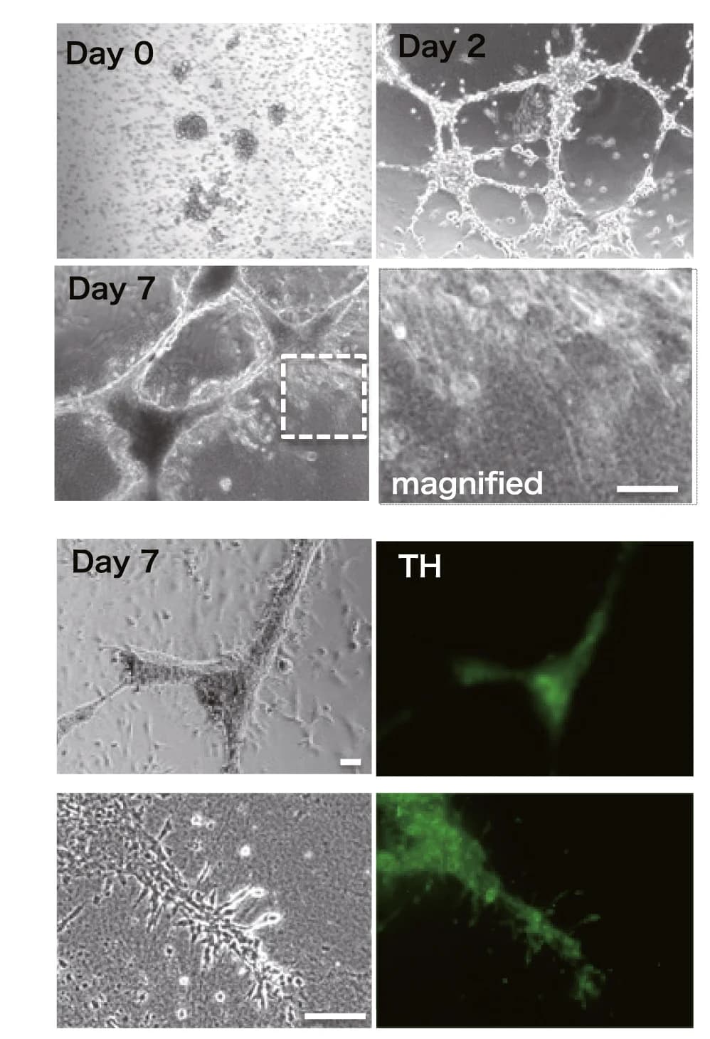 Open access visualization of Microscopy, Photo, Phase-contrast, Green Fluorescence, Differentiated iNSLCs
