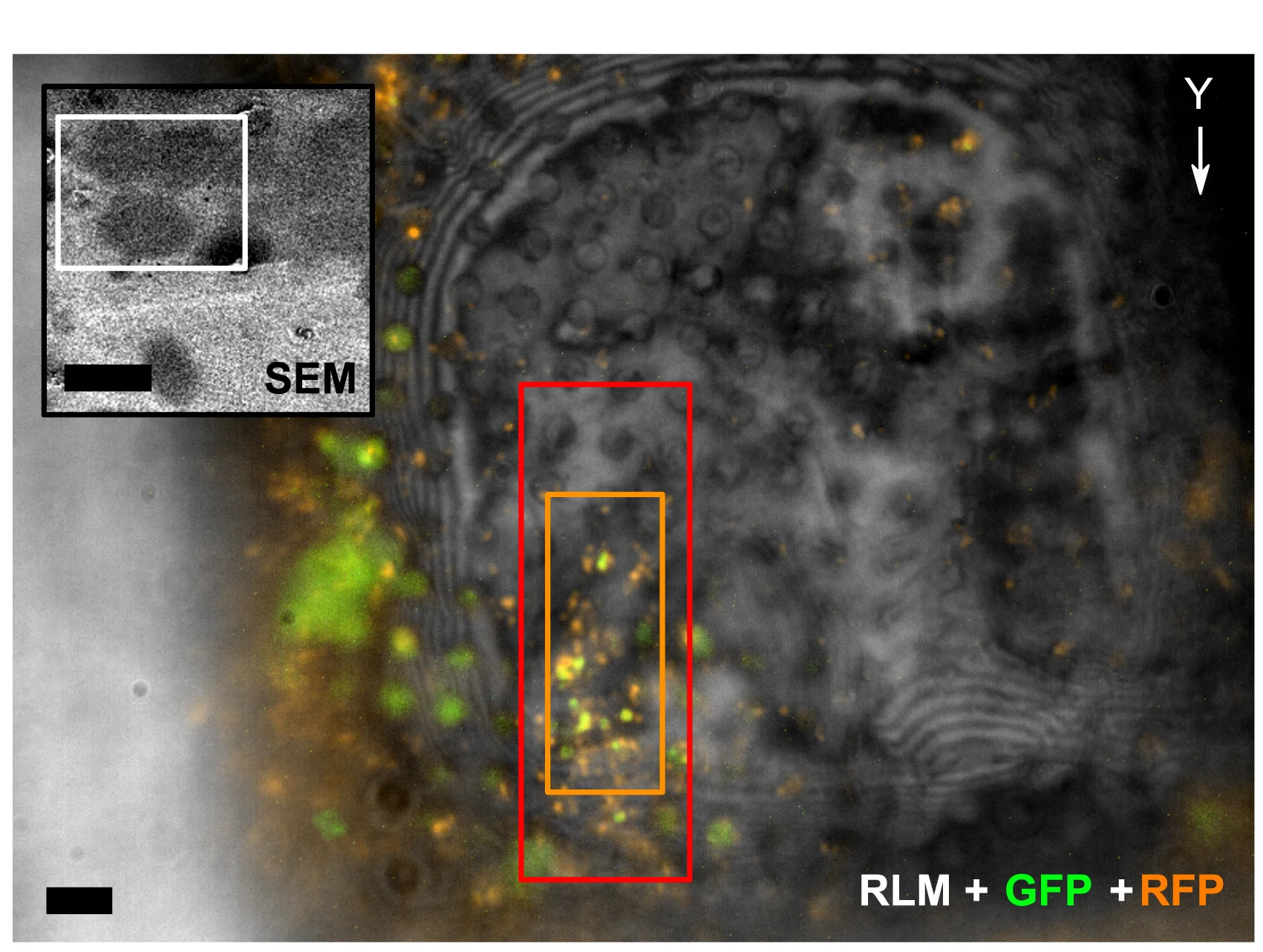 Open access visualization of Microscopy, HeLa Cells, mRFP-GFP-LC3, Fluorescence Microscopy, Reflected Light
