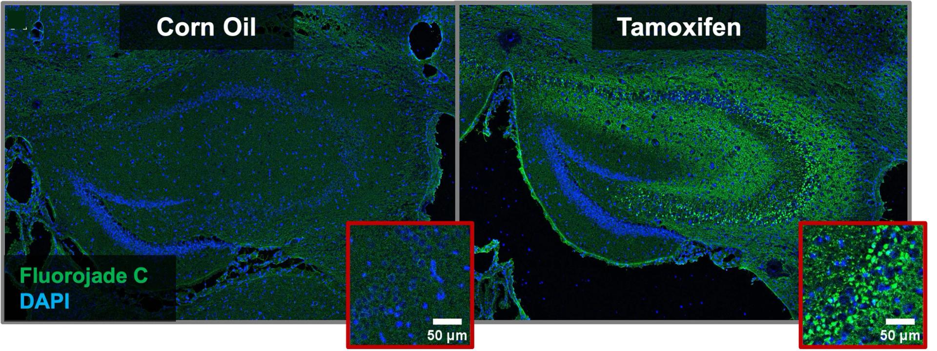 Open access visualization of Microscopy, Fluorojade C, DAPI Staining, Diphtheria Toxin A Mice, Neuronal Degeneration