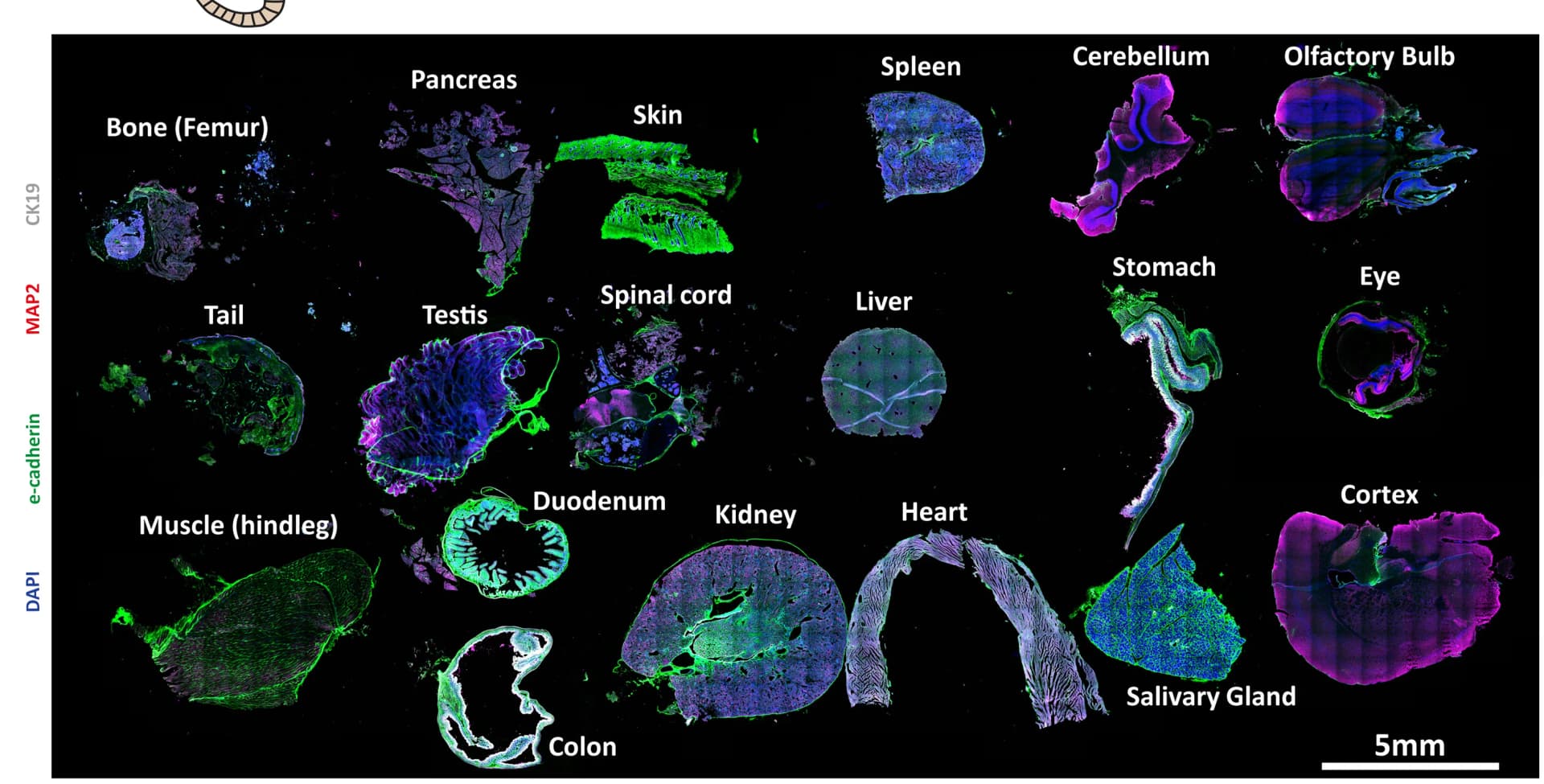 Open access visualization of Microscopy, Immunostaining, E-Cadherin, MAP2, CK19