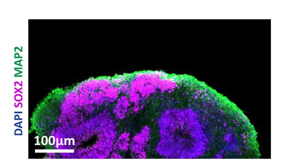 Open access visualization of Microscopy, Organoid, Fluorescent Immunolabeling, SOX2, MAP2