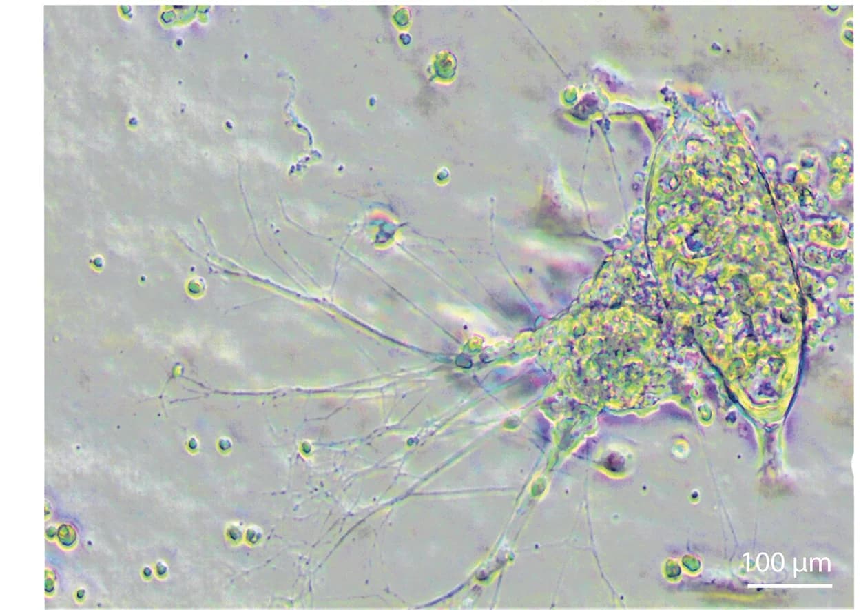 Open access visualization of Microscopy, Bright-Field Image, Organoid