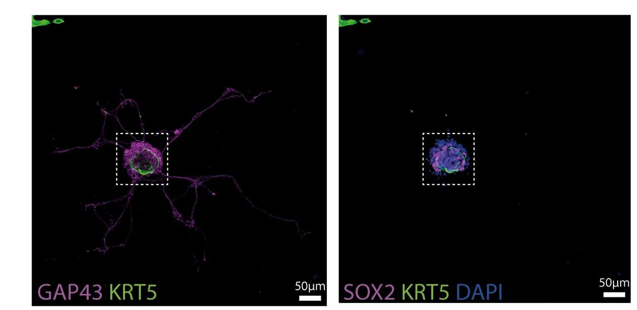 Open access visualization of Microscopy, Immunostaining, Organoid, iOSNs, HBCs