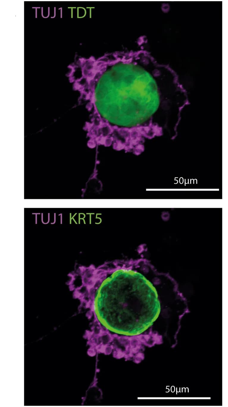 Open access visualization of Microscopy, Immunostaining, Organoid, Lineage Tracing, Mouse Model