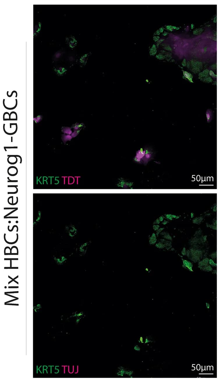 Open access visualization of Microscopy, Immunostaining, HBCs, Neurog1-GBCs