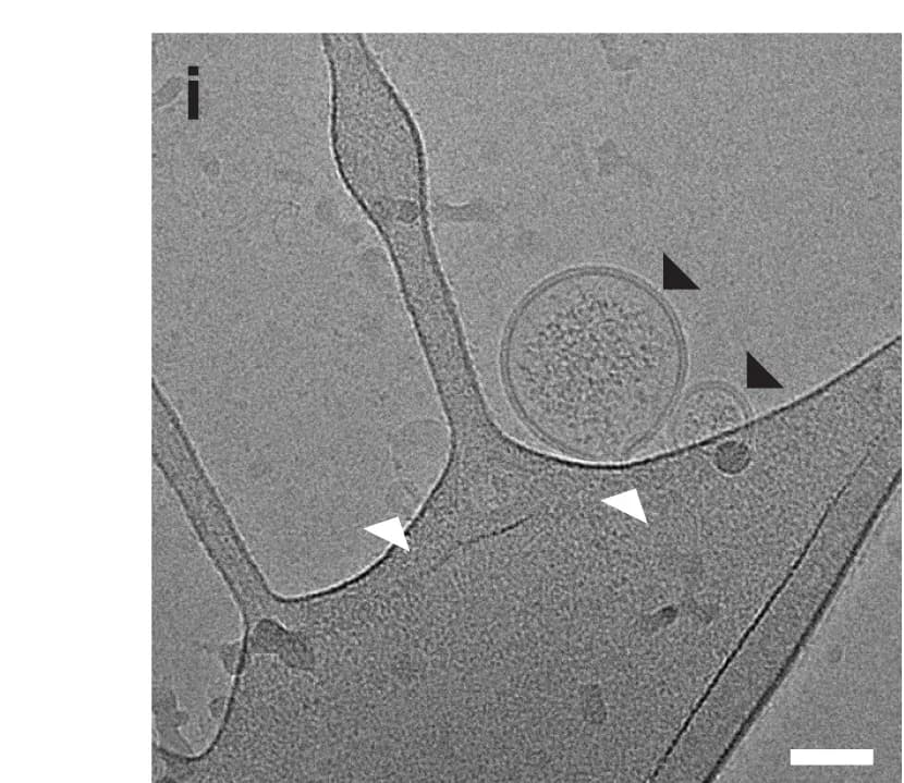 Open access visualization of Microscopy, Cryo-TEM, Vesicles, Sonication, DNase