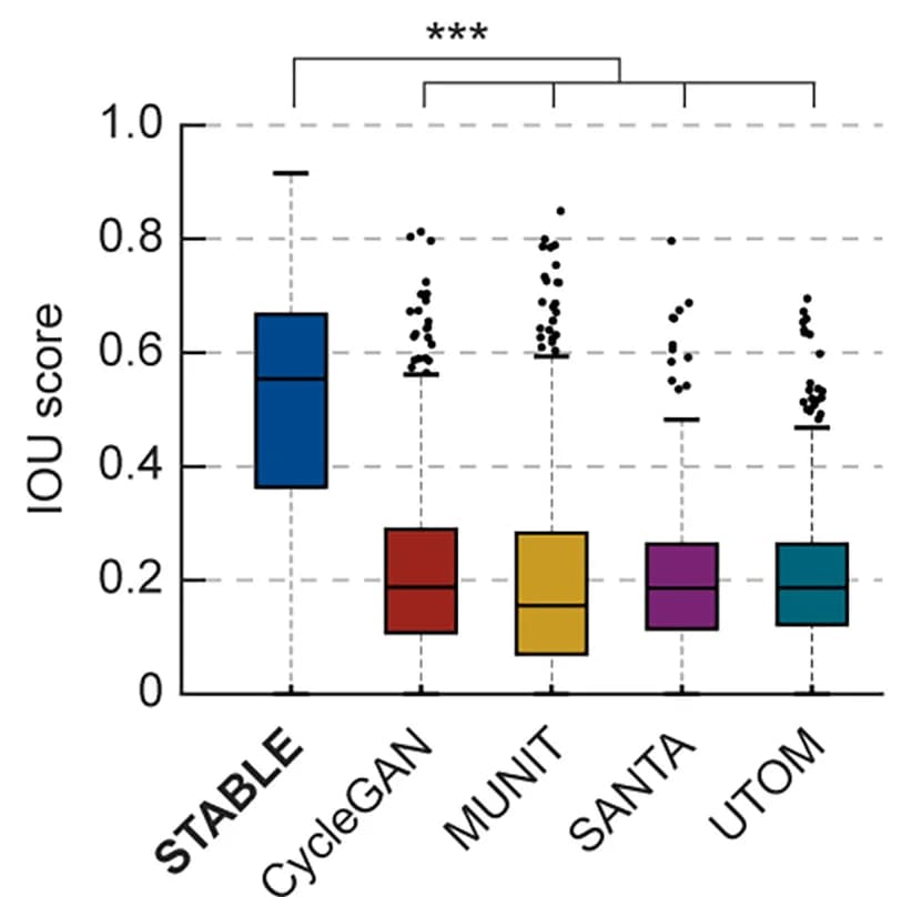 Open access visualization of Box Plot, Scatter Plot, Box-and-Whisker Plot, Intersection over Union, ROIs