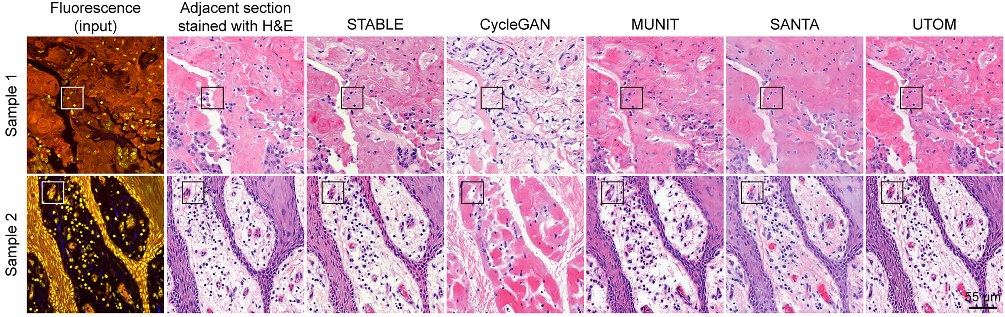 Open access visualization of Microscopy, STABLE, Image-to-Image Translation, Virtual H&E Staining, Two-Photon Fluorescence Microscopy