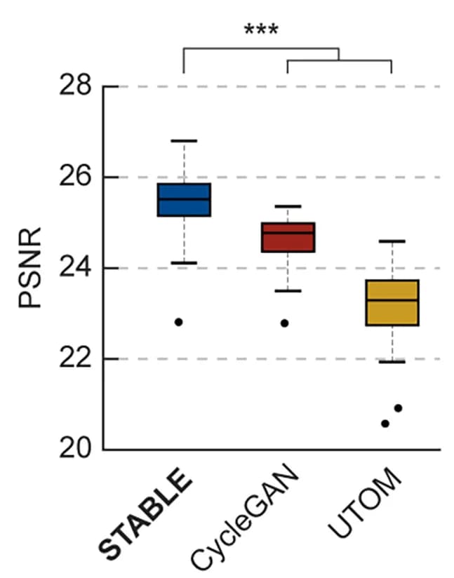 Open access visualization of Box Plot, Box-and-Whisker Plots, Quantitative Comparison, PSNR, T-Tests