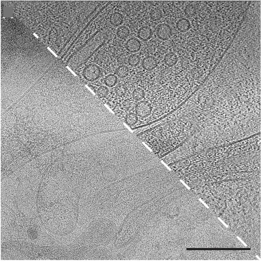 Open access visualization of Microscopy, Raw Image, Motion Correction, Reconstruction, Scale Bar