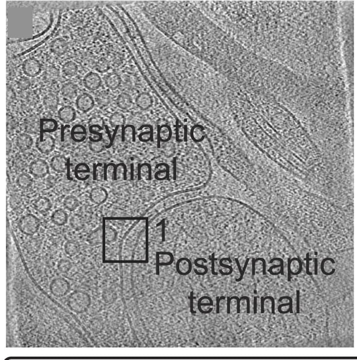 Open access visualization of Microscopy, Tomograms, Synaptic Vesicle Fusion, Scale Bar