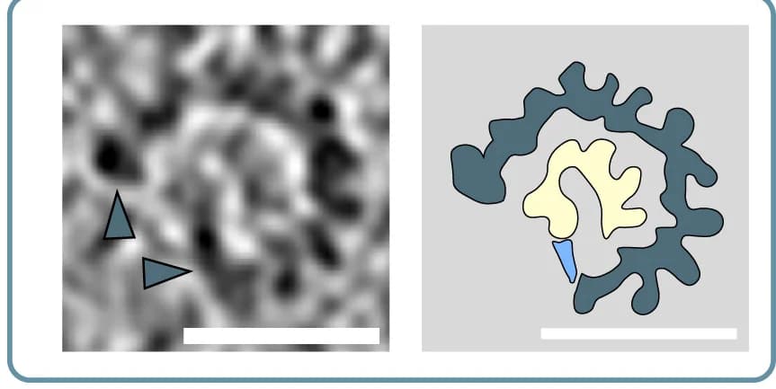 Open access visualization of Microscopy, Illustration, Microtubule, Protofilaments, Density