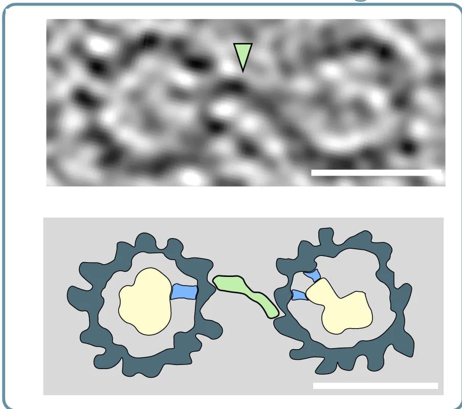 Open access visualization of Microscopy, Illustration, Microtubules, Bridging Density