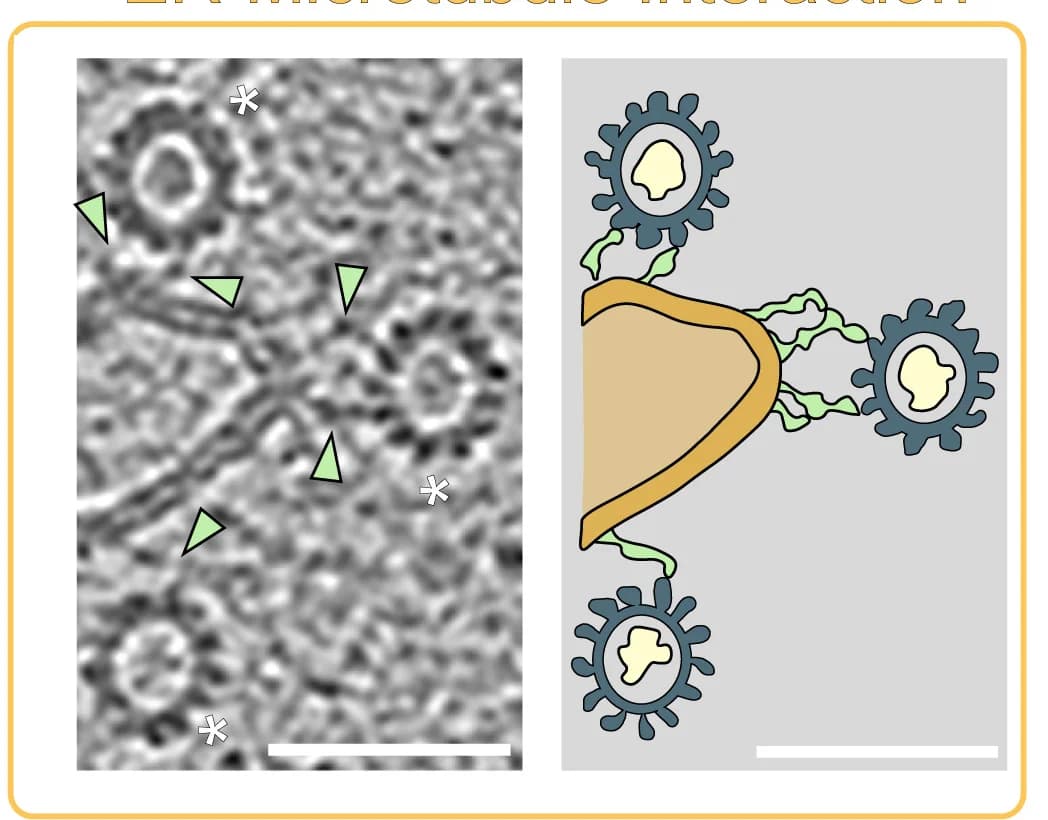 Open access visualization of Microscopy, Illustration, Microtubules, Endoplasmic Reticulum, Bridging Densities