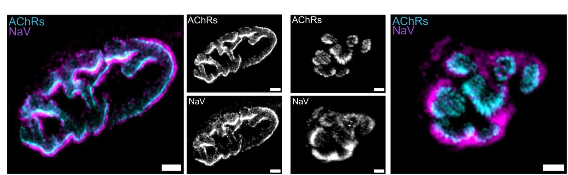 Open access visualization of Microscopy, Confocal Micrographs, Expanded NMJs, Mouse Muscle Biopsies, Human Muscle Biopsies
