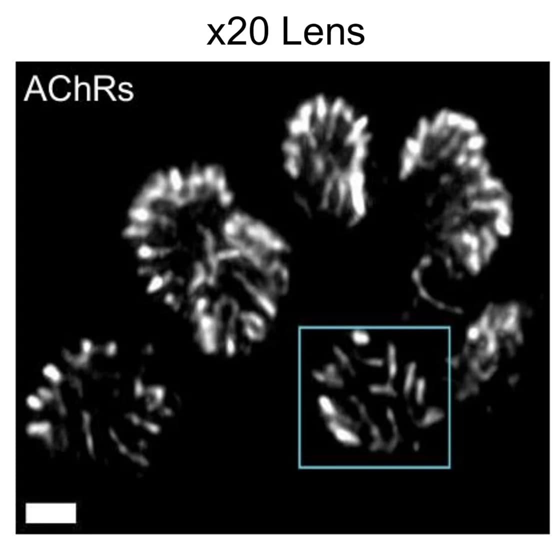 Open access visualization of Microscopy, Expanded NMJ, AChRs, ExM Images, Fluorophores