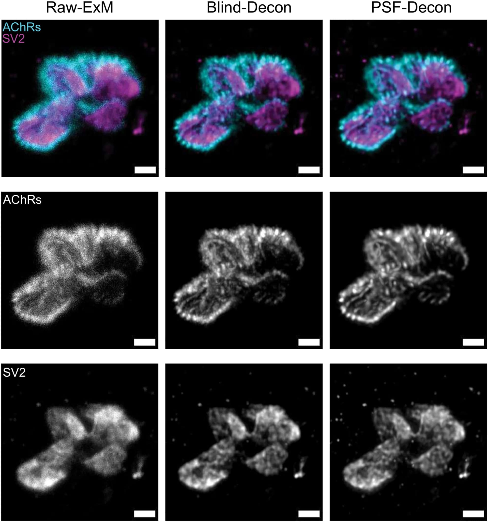 Open access visualization of Microscopy, Deconvolution, Expanded NMJs, Human NMJs, Maximum Likelihood Estimation