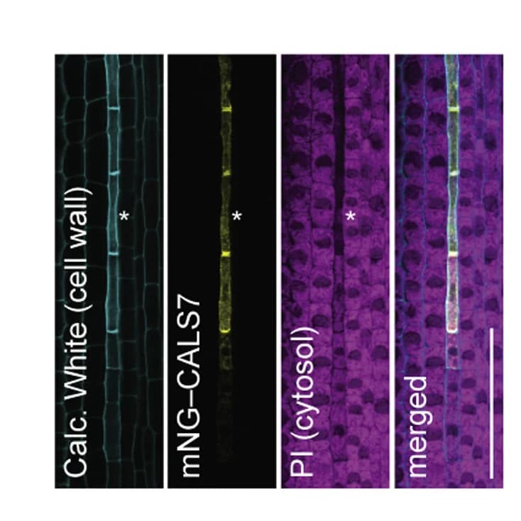 Open access visualization of Microscopy, Cell Wall, Cytosol