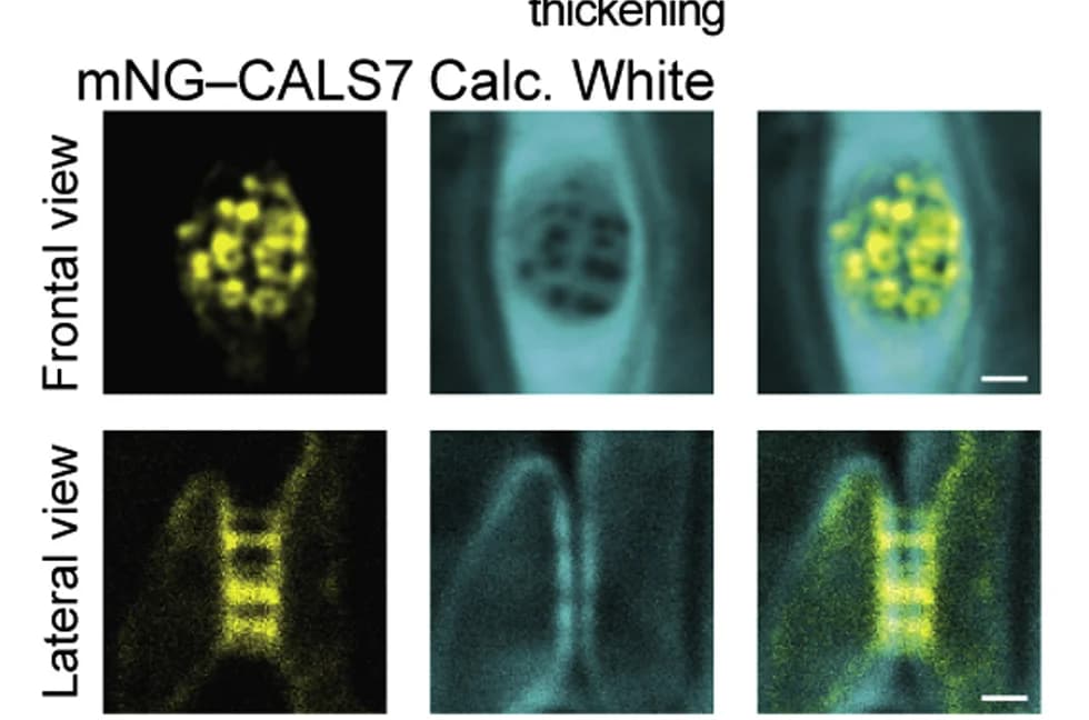 Open access visualization of Microscopy, Sieve Plates, Leaf petioles, Cell walls, Sieve Pores