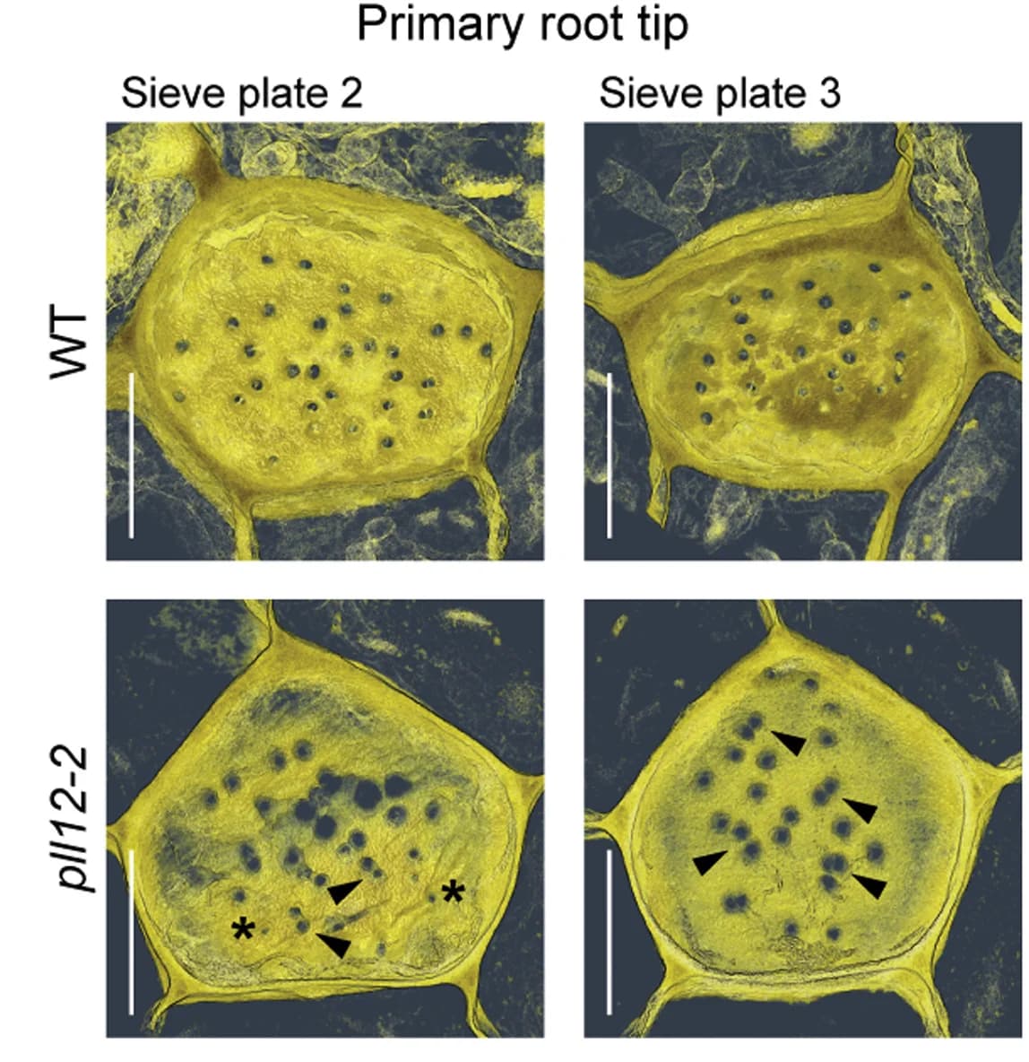 Open access visualization of Microscopy, Volume Rendered Projection, Serial Block Face Scanning Electron Micrographs, Sieve Plates, Root Protophloem