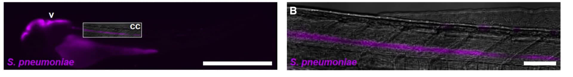 Open access visualization of Microscopy, Fluorescence Image, Larva, S. pneumoniae, Brain Ventricle