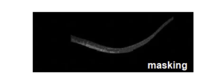 Open access visualization of Microscopy, Red Channel Fluorescence, Spinal Cord, Infected Larvae, S. pneumoniae