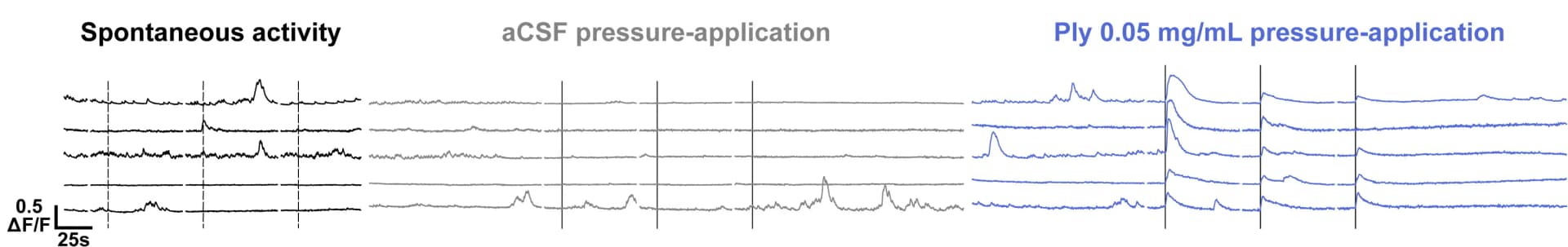 Open access visualization of Line Plot, In Vitro, CSF-cN, Calcium Traces, No Stimulation Control