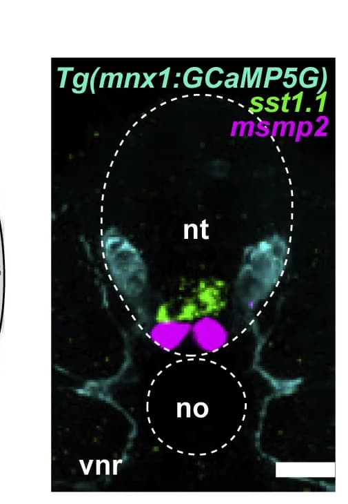 Open access visualization of Microscopy, Fluorescence In Situ Hybridization, Immunofluorescence, Motor Neurons, dCSF-cNs
