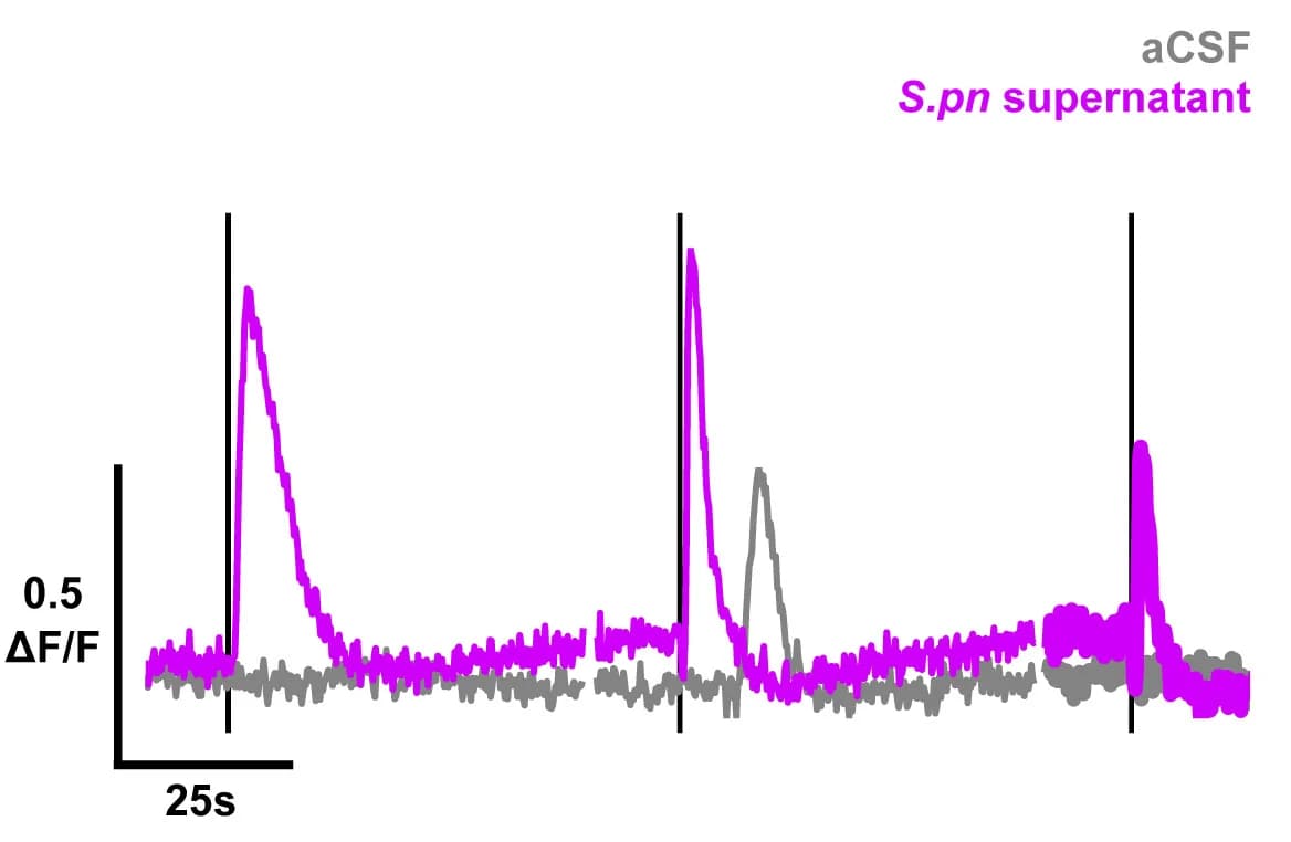 Open access visualization of Line Plot, CSF-cN, Calcium, aCSF, Supernatant
