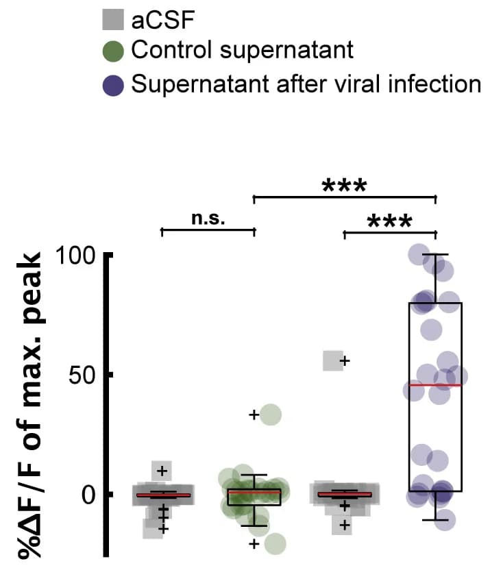 Open access visualization of Box Plot, Scatter Plot, Calcium Transients, aCSF, Viral Infection