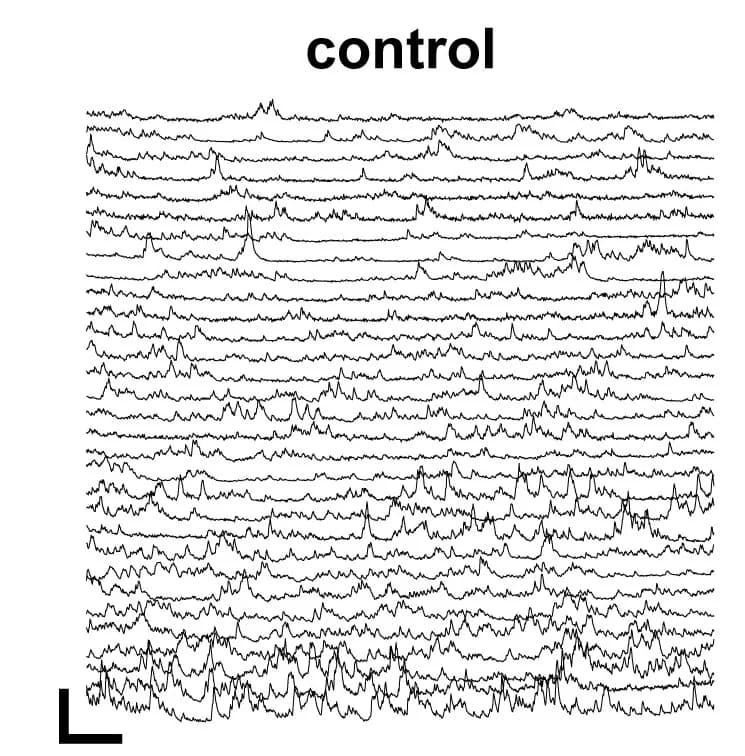 Open access visualization of Line Plot, Density Plot, Calcium, CSF-cNs, Larvae