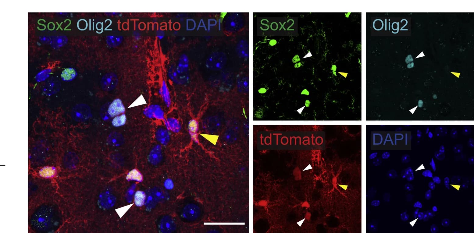 Open access visualization of Microscopy, Olig2+/Sox2+ AD-tdTomato+-NSCL Cells, p53Gfap-icKO, Cell Division