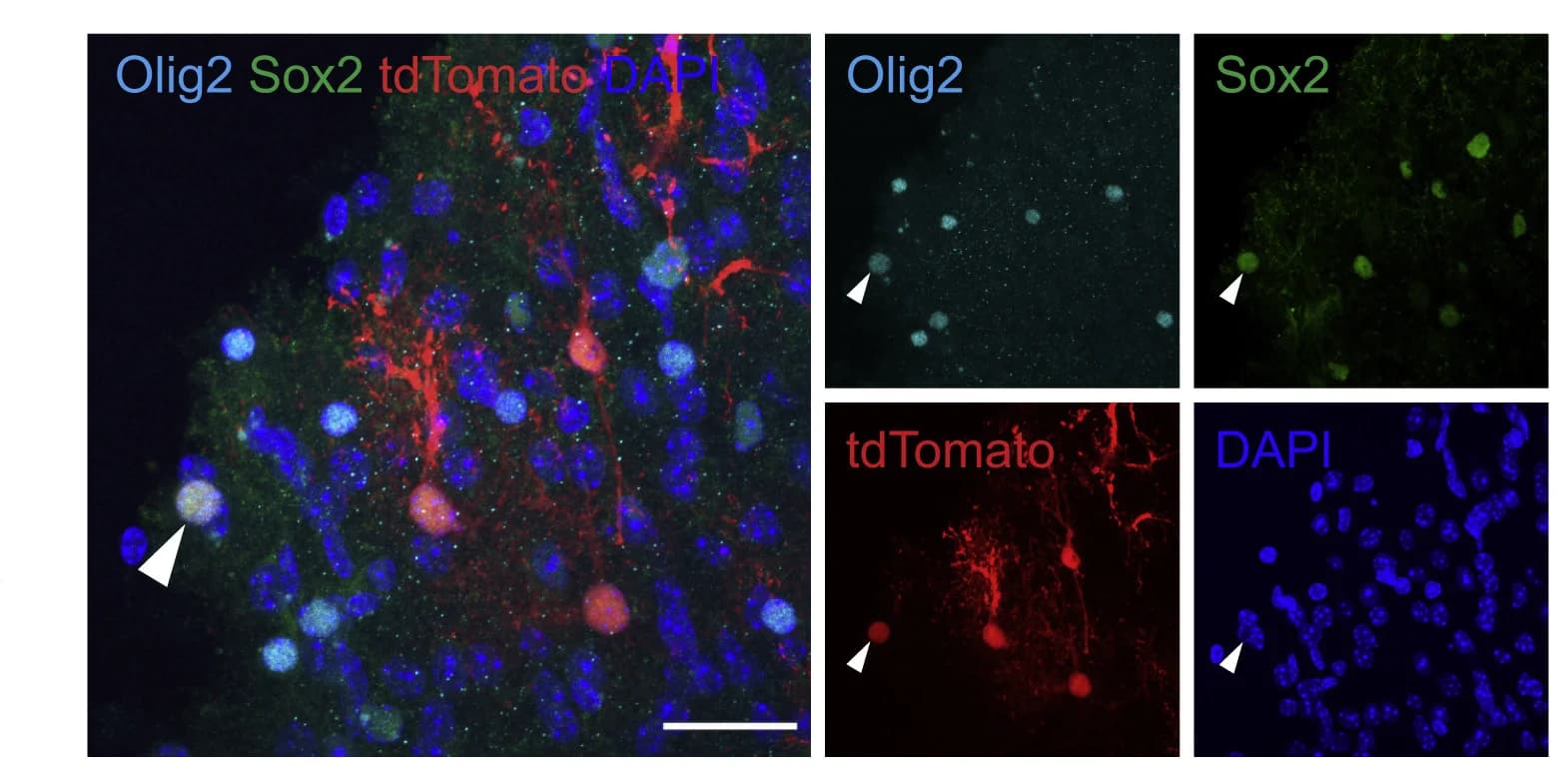 Open access visualization of Microscopy, AD-tdTomato+-NSCL Cells, Lipopolysaccharide, p53Gfap-icKO