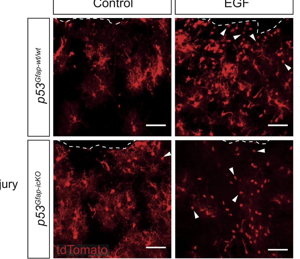 Open access visualization of Microscopy, tdTomato Cells, Cell Morphology, AD-tdTomato Cells, Representative Image