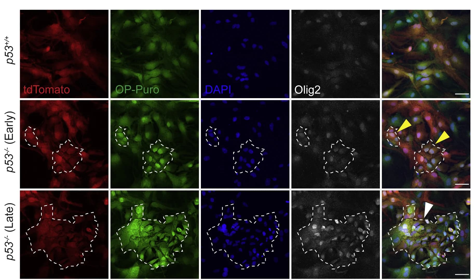 Open access visualization of Microscopy, OP-puro Labeling, Olig2 Staining, Protein Synthesis, Cell Clusters