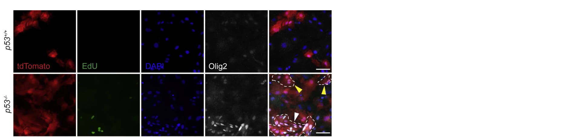 Open access visualization of Microscopy, Olig2 Staining, EdU Incorporation, Cell Proliferation, Cell Clusters