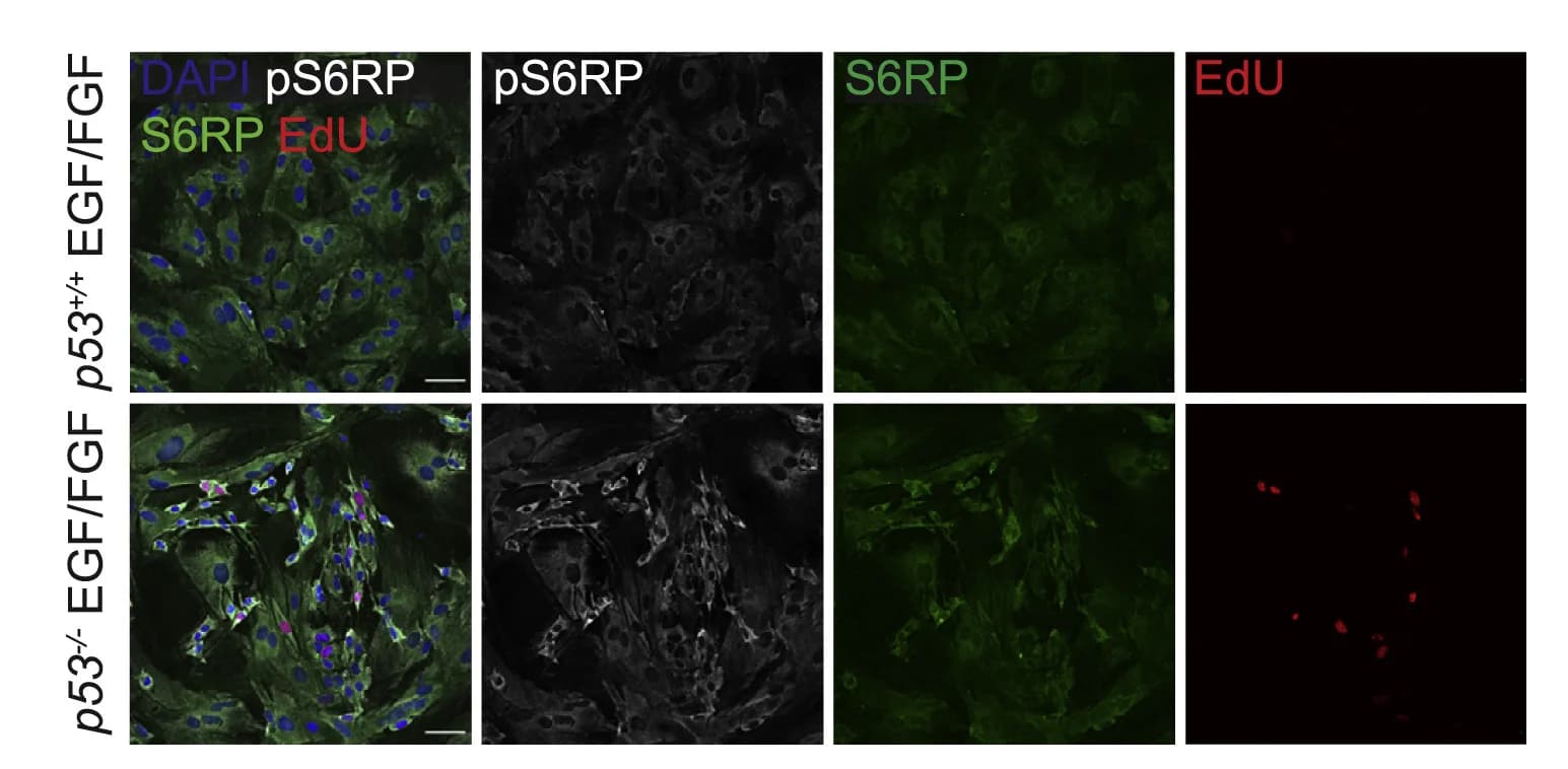 Open access visualization of Microscopy, Phospho-S6 Ribosomal Protein, S6RP Staining, Astrocytes, EGF/FGF