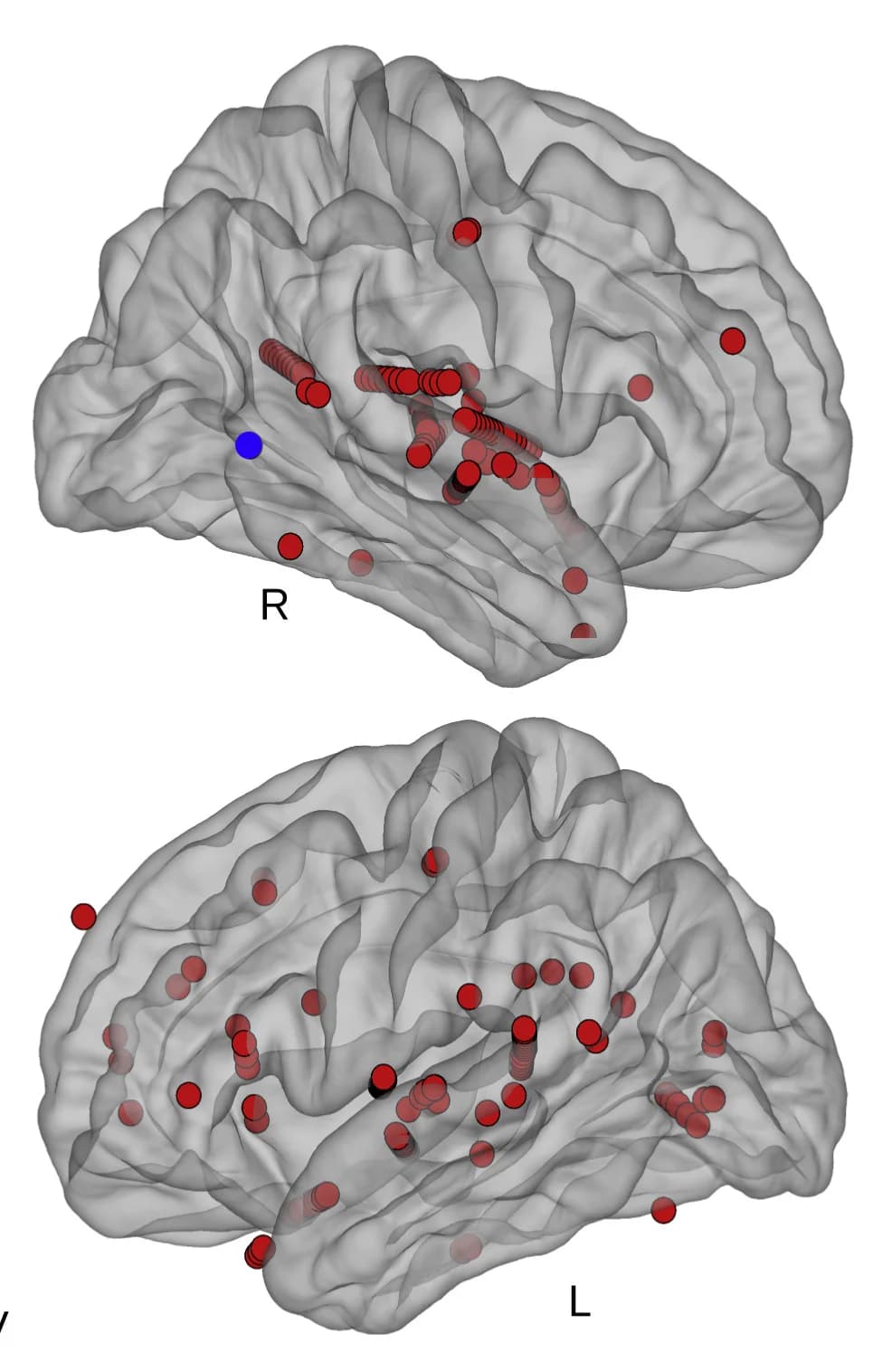 Open access visualization of 3D Plot, Auditory Selective Electrodes, Anatomical Distribution, Average Brain, Localizer Task