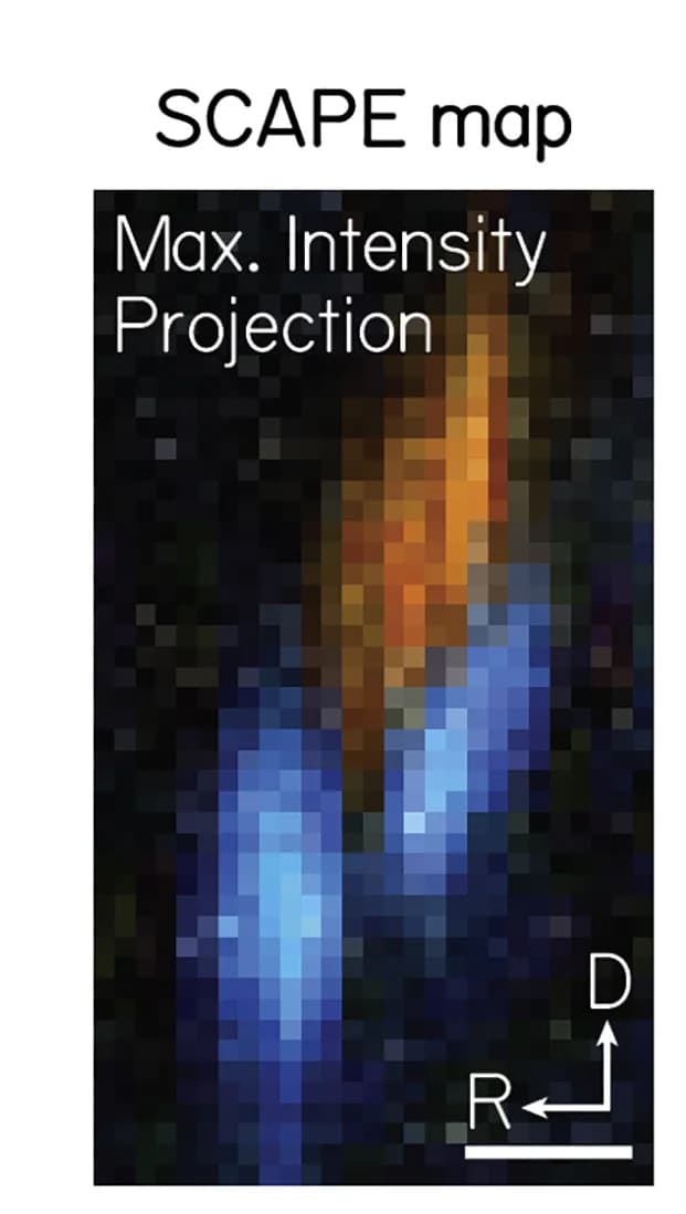 Open access visualization of Microscopy, Maximum Intensity Projection, Tangential Nucleus, SCAPE Imaging