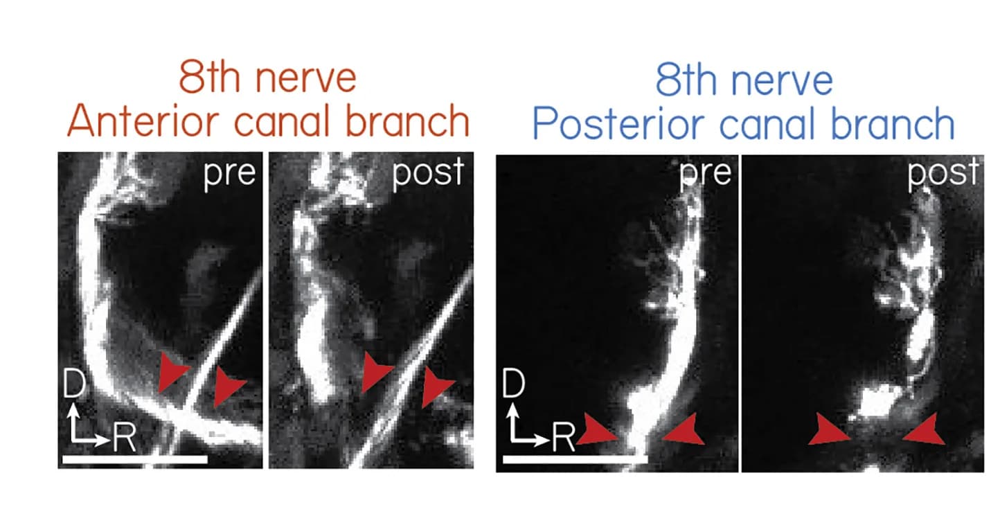 Open access visualization of Microscopy, Larva, VIIIth Nerve Lesion, Semicircular Canal, Fluorescence Imaging