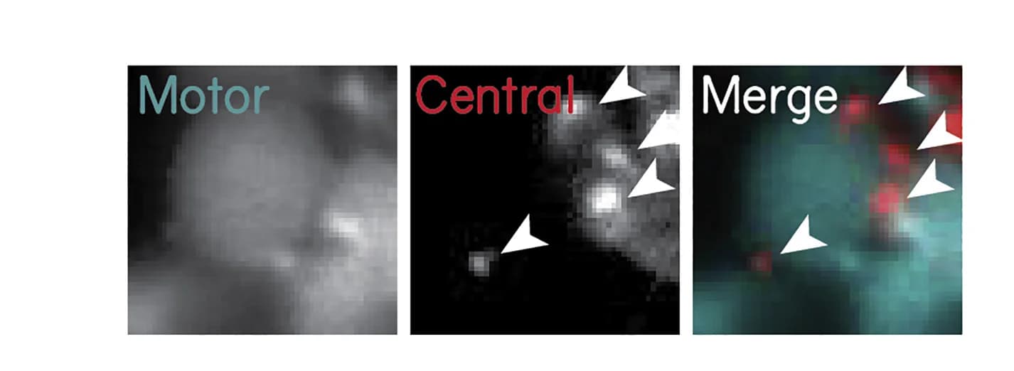Open access visualization of Microscopy, Extraocular Motor Neuron, Axo-somatic Varicosities