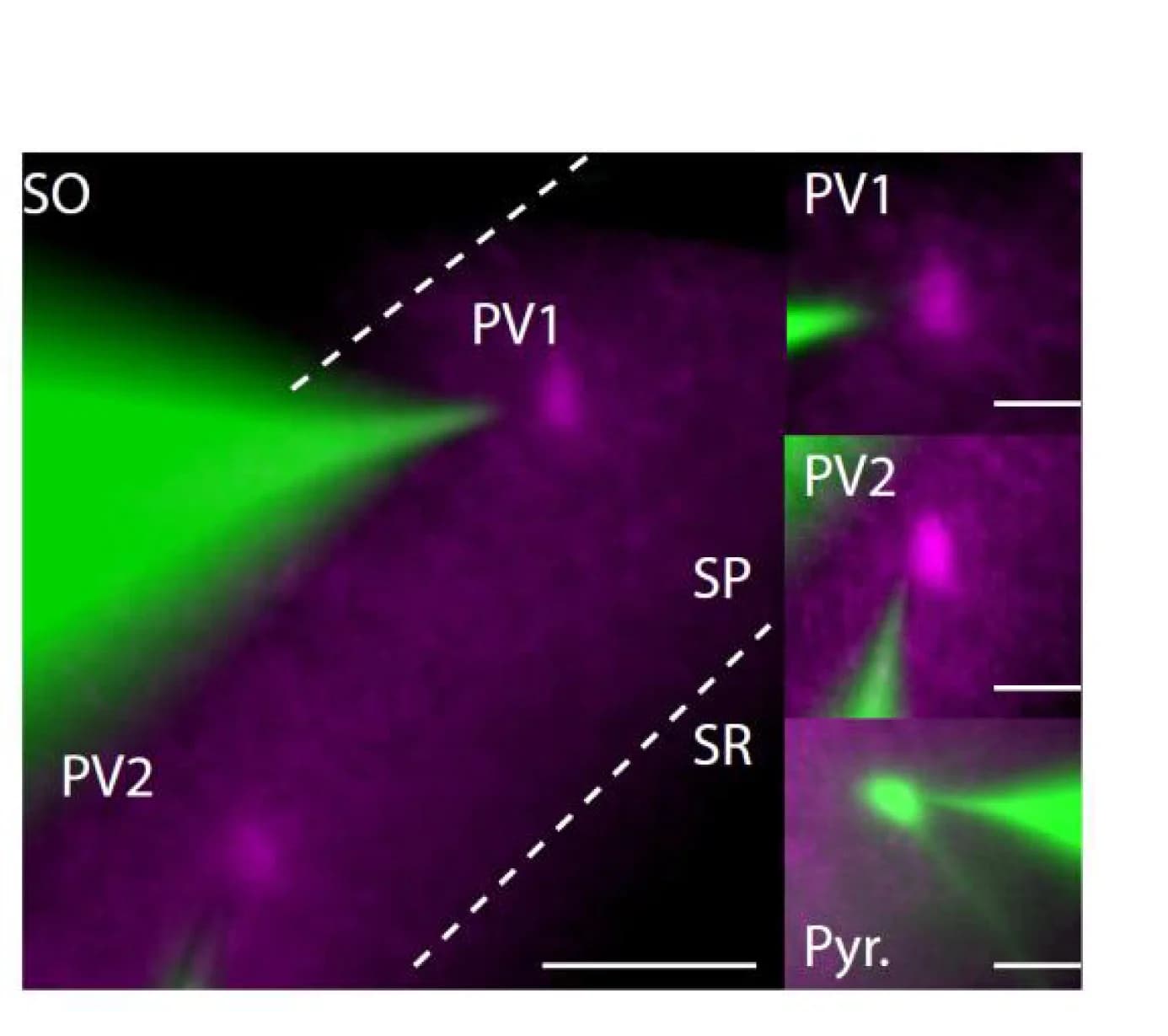 Open access visualization of Microscopy, Dual Cell-attached Recordings, FS PV+ Interneurons, Voltage-clamp Recording, CA1 Pyramidal Cell