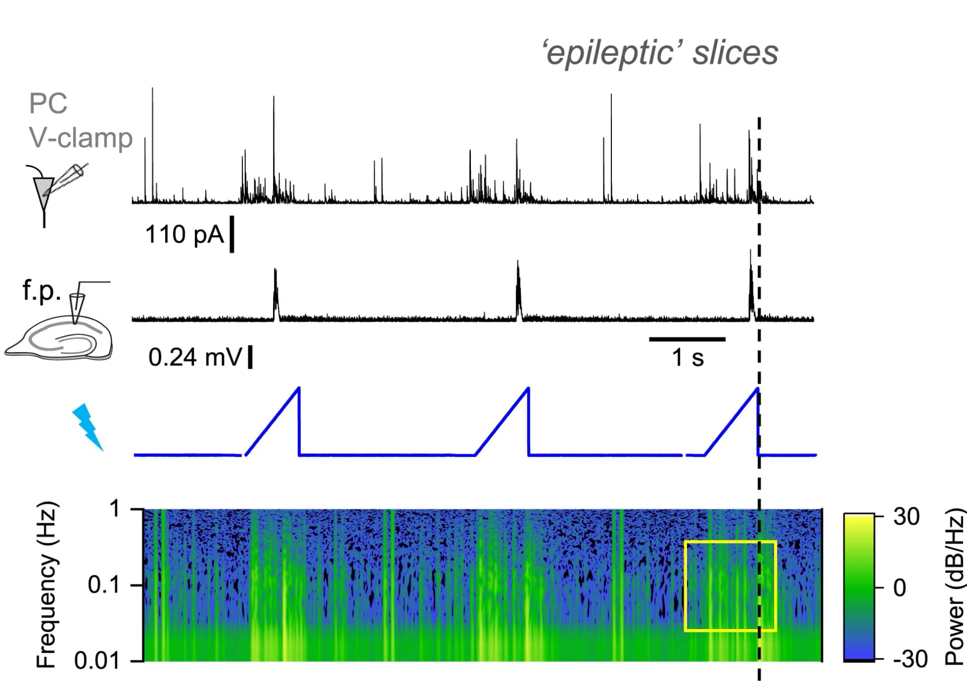 Open access visualization of Line Plot, Spectrogram, Epileptogenic Tissue, GABAAR Current, Pyramidal Neurons