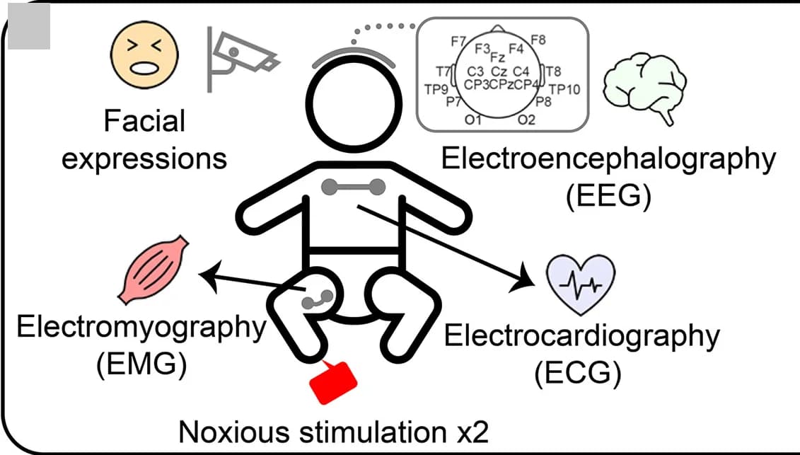 Open access visualization of Illustration, Workflow, Recording Setup