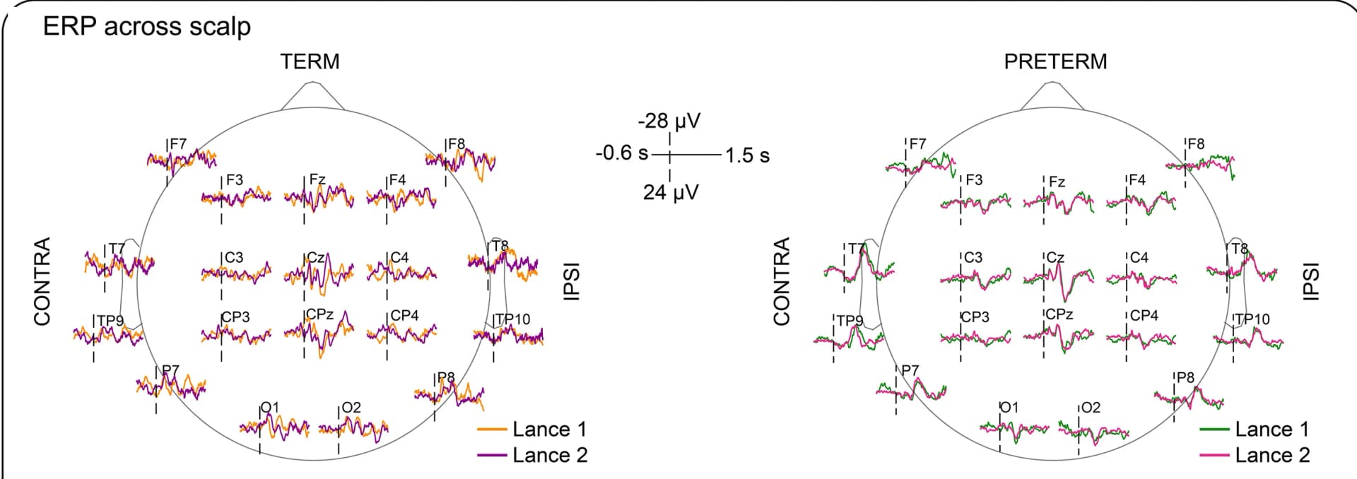 Open access visualization of Line Plot, Event-Related Potentials, Electroencephalography, Neonates, Scalp