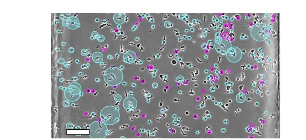 Open access visualization of Microscopy, Experimental Verification, Cell Tracking, NC4 Cells, Cell Movement