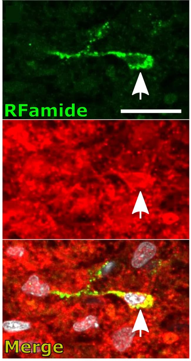 Open access visualization of Microscopy, Donor-derived Neuron, Epithelial Cells, RFamide, mScarlet