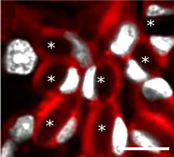 Open access visualization of Microscopy, Nematocytes, Nematocyst Capsules, Nucleus