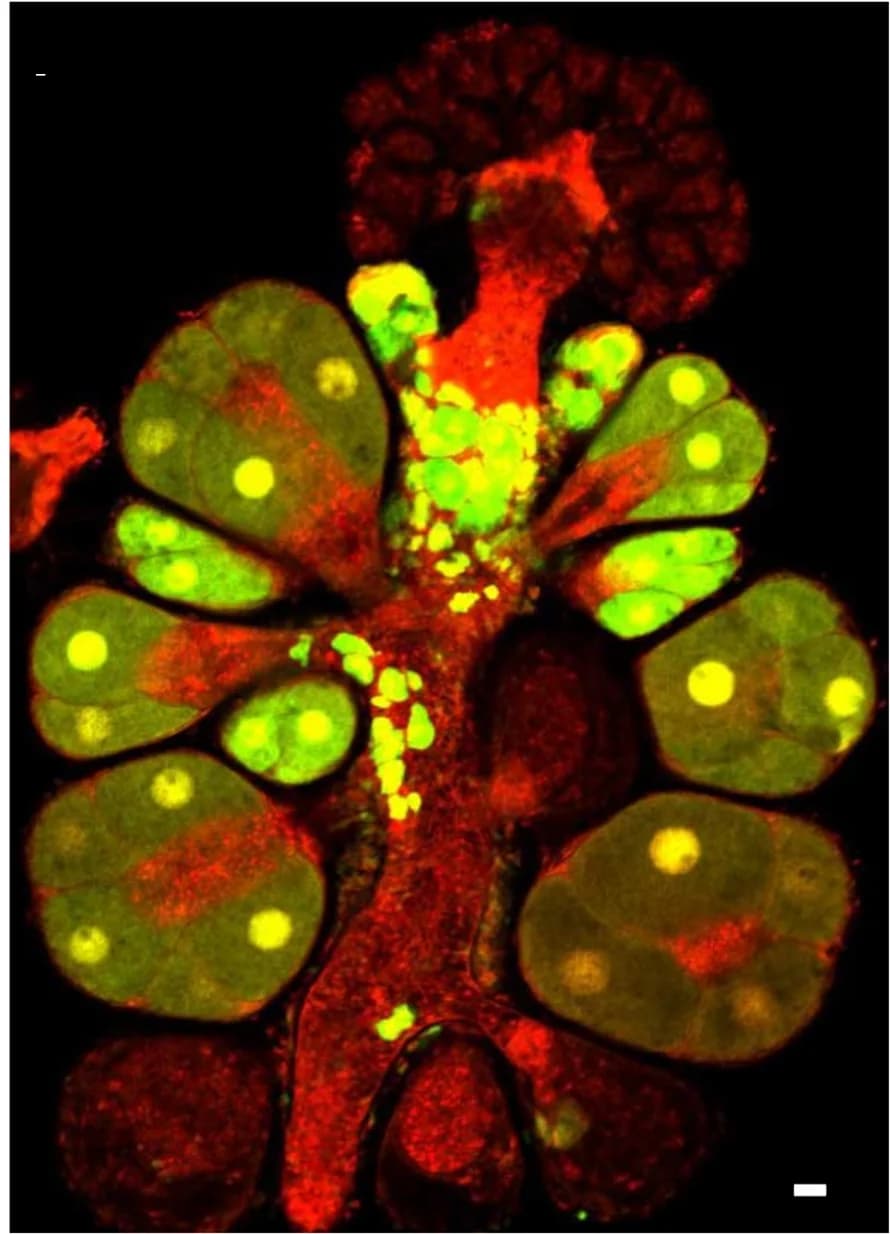 Open access visualization of Microscopy, Sexual Polyp, Donor Cells, I-cells, Germ Cells