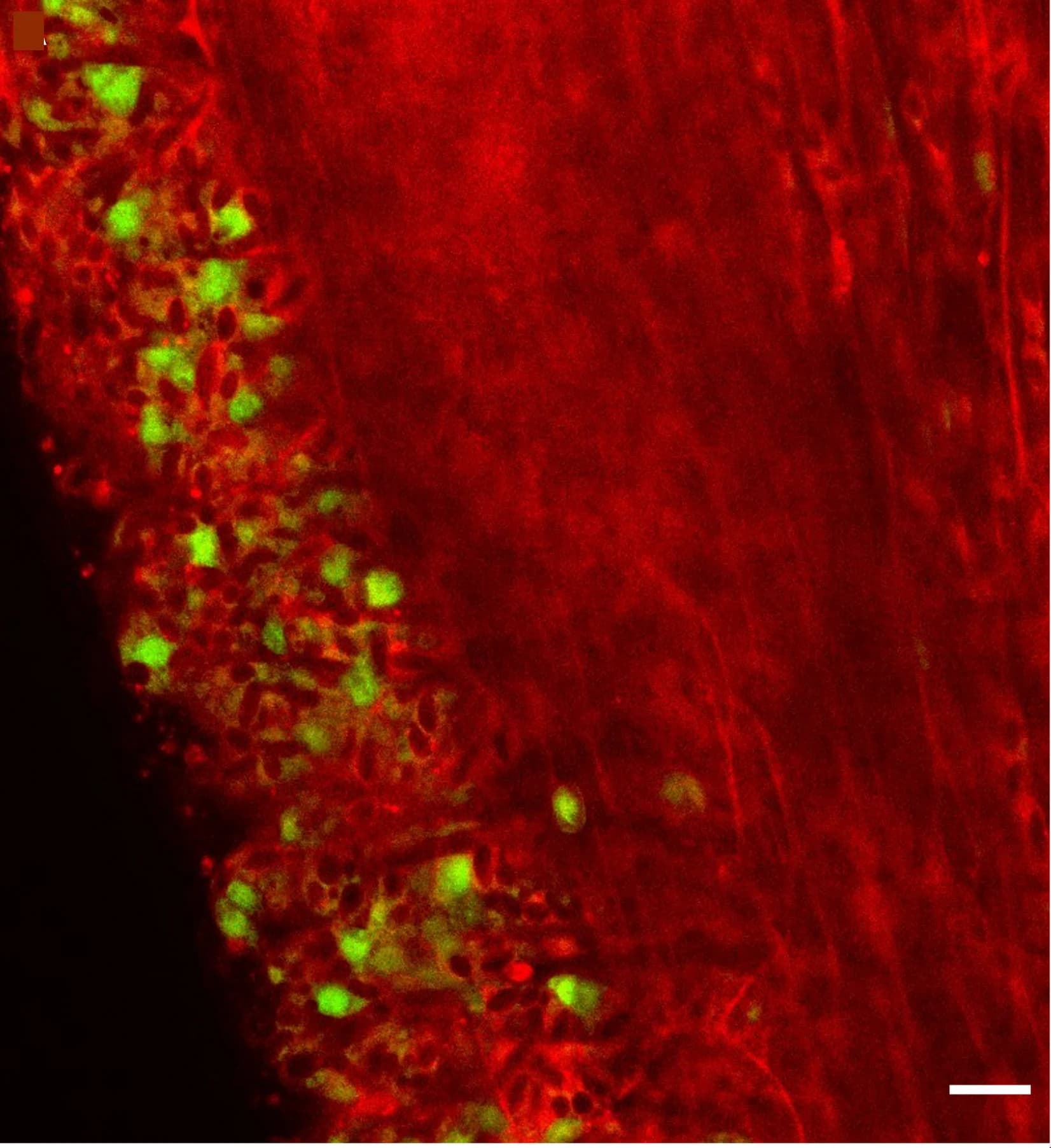 Open access visualization of Microscopy, Confocal Section, Chimera